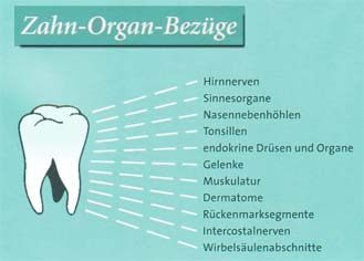 Wechselbeziehung zwischen Zähnen und Organen waren schon in China bekannt. Die ganzheitliche Zahnmedizin mit naturheilkundlicher Ausrichtung bezieht diese Wechselbeziehungen in die Behandlung mit ein.